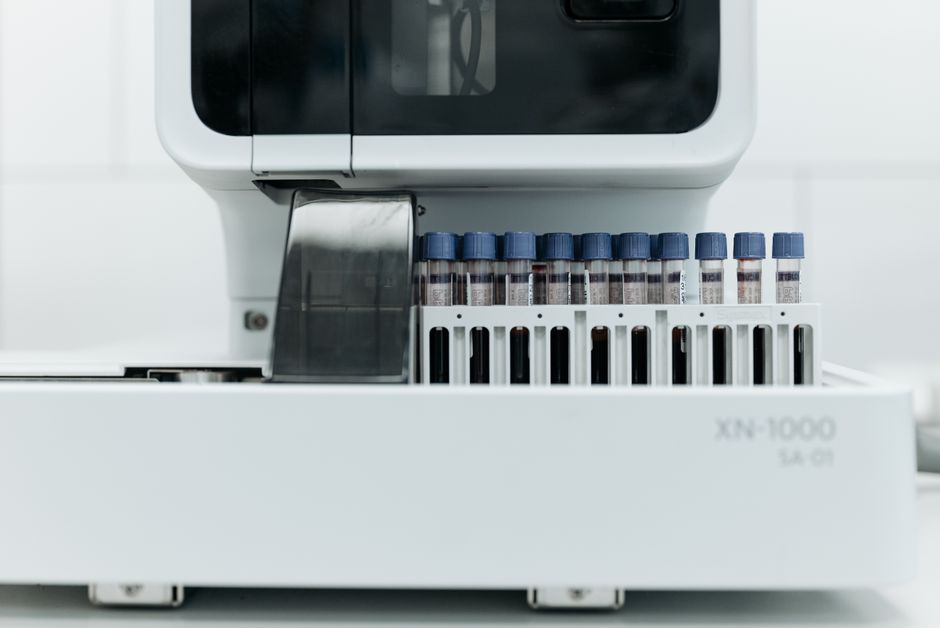 Proteomics International Secures US Patent for PromarkerEndo Endometriosis Blood Test